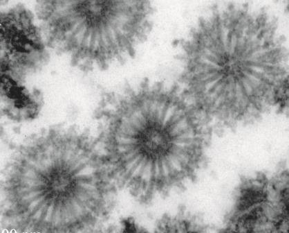 «Ежики» в тумане: ученые обнаружили неизвестные вирусоподобные частицы внутри мшанок
